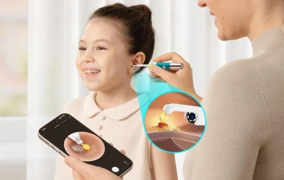 Bebird Earsight Ultra tyrkysovo-měděný kamerový otoskop