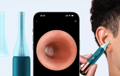 Bebird Earsight Ultra tyrkysovo-měděný kamerový otoskop