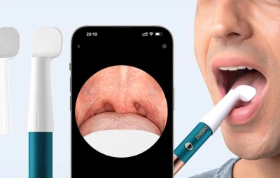 Bebird Earsight Ultra tyrkysovo-měděný kamerový otoskop