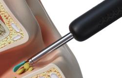 Bebird Otoskop pro čištění uší R1 s kamerou (černý)