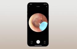 Bebird Otoskop s kamerou na čištění uší M9 S (černý).