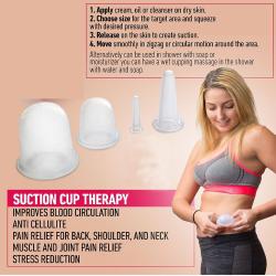 Merco Cups 4Pack masážní silikonové baňky růžová