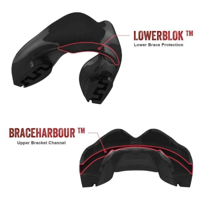 Safe Jawz Chránič zubů Ortho Series Solid Black