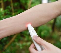Sorbo Zklidňující termo pero Itch Healer