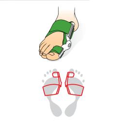 Svorto Hallux Valgus s kloubem bandáž na palec