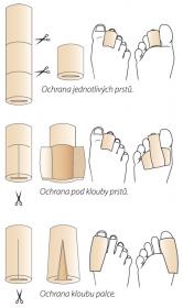 Svorto Návlek na prst