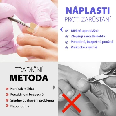 Wellife Náplasti proti zarůstání nehtů 100 ks